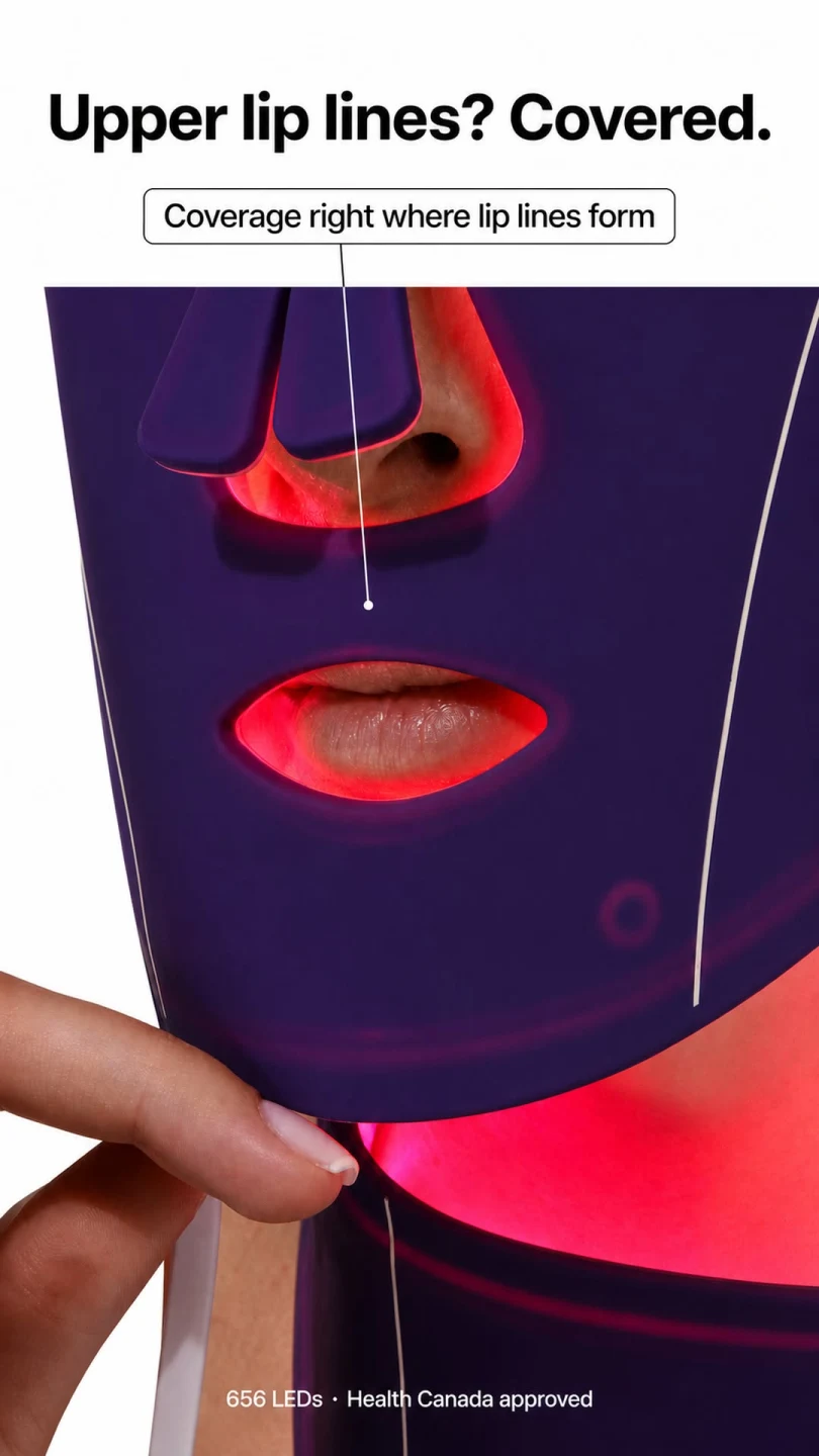Luyors upper-lip coverage ad showing the purple LED mask and its coverage callout.